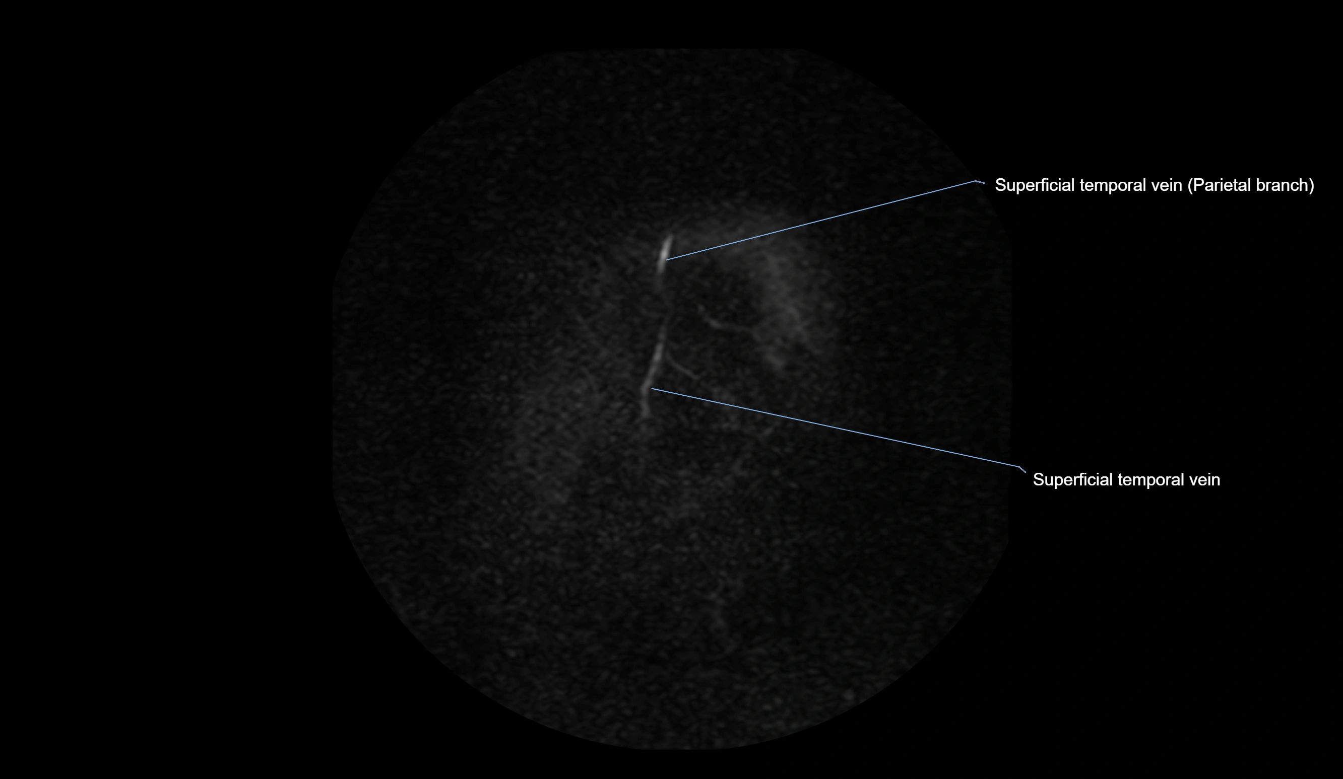 MRV brain sagittal anatomy 3T MRI images -img-01015-00008.webp